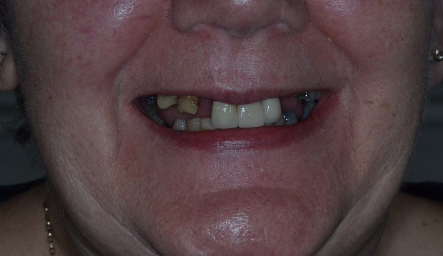 Before - Durham Dental