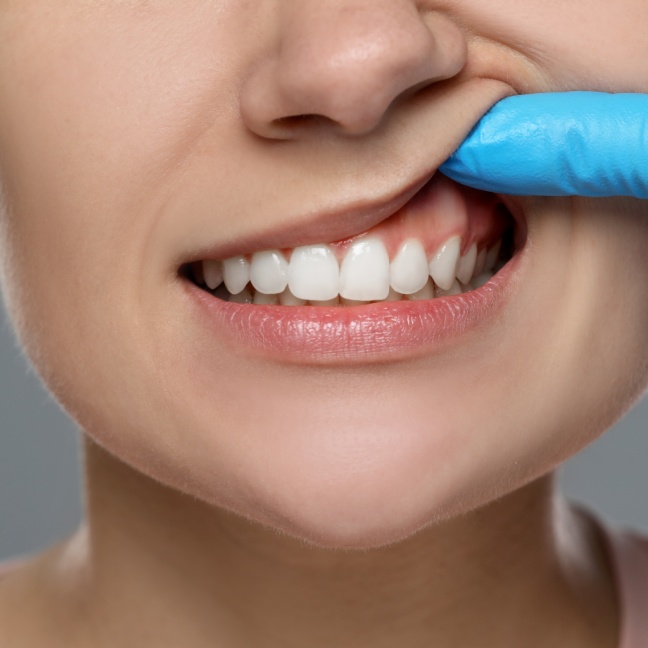 blog - Durham Dental